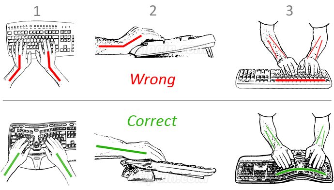 Equipment Repetitive Strain Injury Rsi