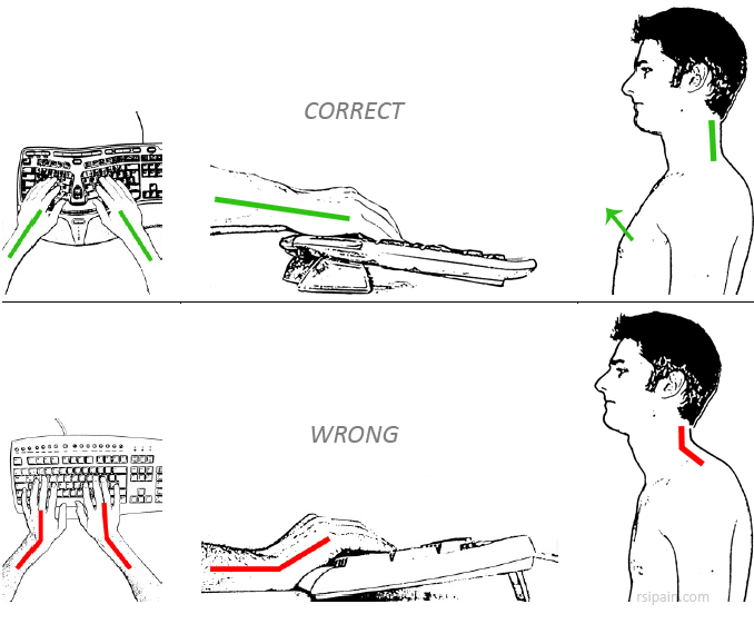 RSI ergonomic posture