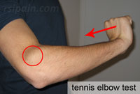 Tennis elbow test
