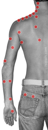 Trigger points back view