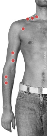 Trigger points front view